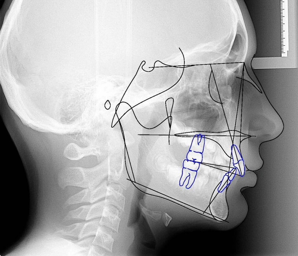 Ceph Tracing Cephanalysis