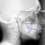 Ceph Tracing Cephanalysis