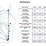 Cephalometrics And Superimposition Fundamentals