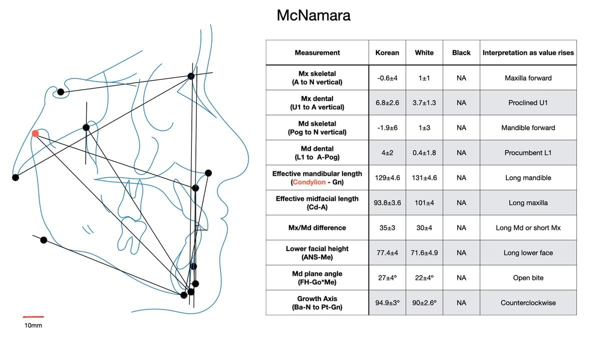 Cephalometrics And Superimposition Fundamentals