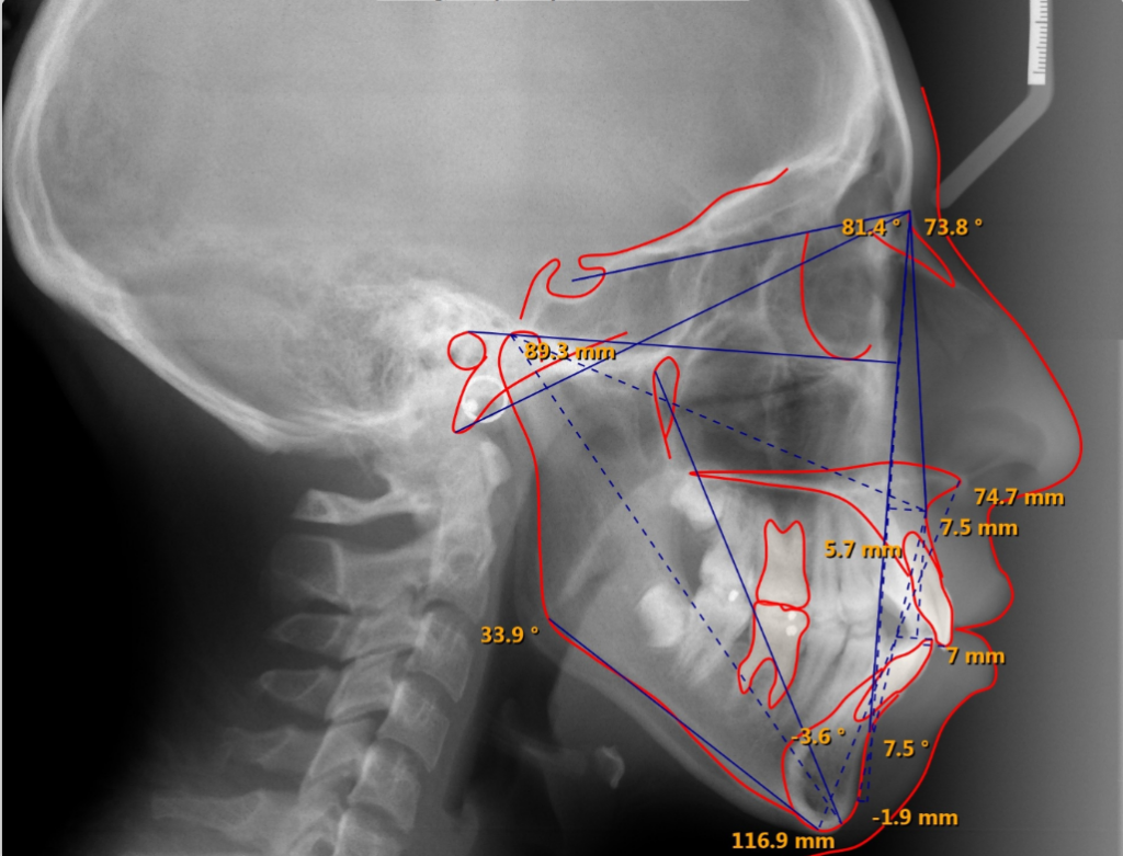 Ortho2 Edge Imaging