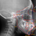 Ortho2 Edge Imaging